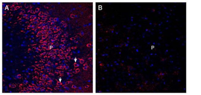 Neuronal Pentraxin Receptor (NPTXR) (extracellular) Antibody in Immunohistochemistry (Frozen) (IHC (F))