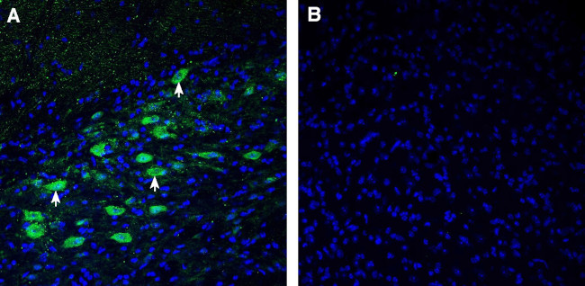CADM1/SynCAM (extracellular) Antibody in Immunohistochemistry (Frozen) (IHC (F))
