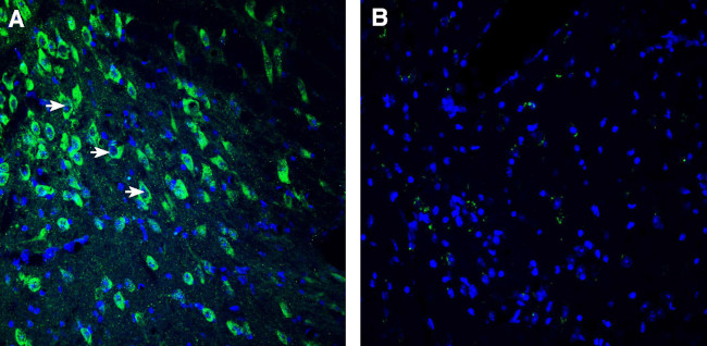 SEZ6 (extracellular) Antibody in Immunohistochemistry (Frozen) (IHC (F))