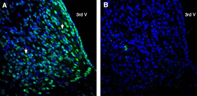 CD81 (extracellular) Antibody in Immunohistochemistry (Frozen) (IHC (F))