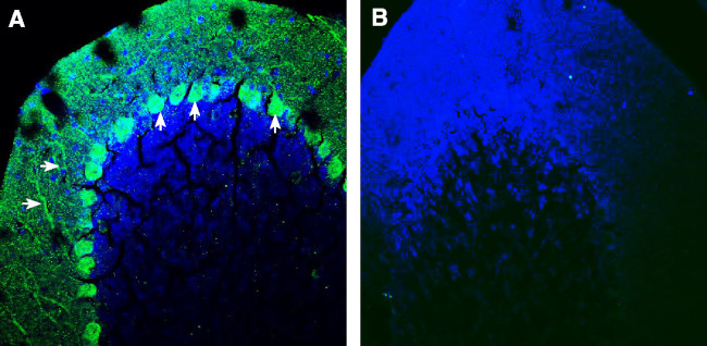 SLIT1 Antibody in Immunohistochemistry (Frozen) (IHC (F))