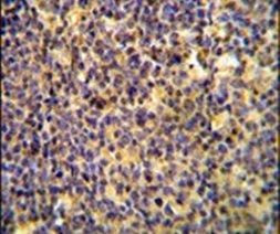 ANR44 Antibody in Immunohistochemistry (IHC)