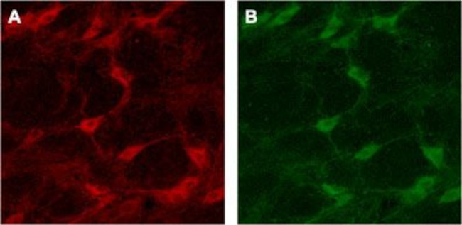 p75 NGF Receptor (extracellular) Antibody in Immunohistochemistry (IHC)