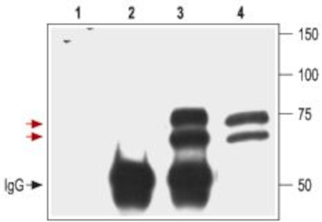 p75 NGF Receptor (extracellular) Polyclonal Antibody | Invitrogen (ANT ...