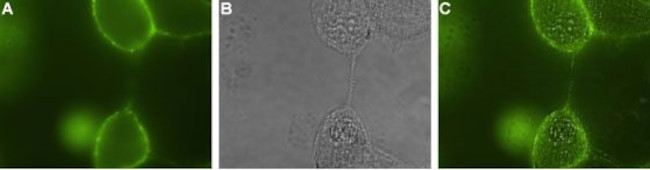 p75 NGF Receptor (extracellular) Antibody in Immunocytochemistry (ICC/IF)