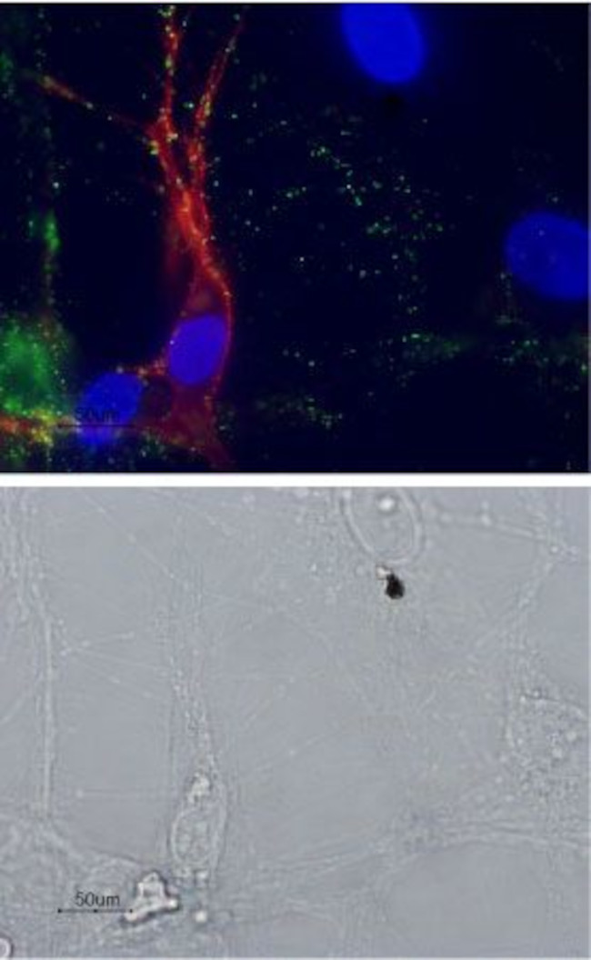 p75 NGF Receptor (extracellular) Antibody in Immunocytochemistry (ICC/IF)