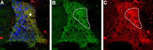 proNT-3 Antibody in Immunohistochemistry (IHC)