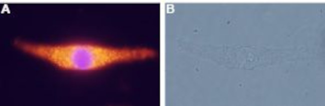 Neurotensin Receptor 2 Antibody in Immunocytochemistry (ICC/IF)
