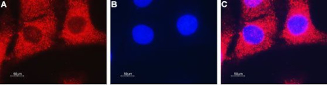 ENT2 (SLC29A2) Antibody in Immunocytochemistry (ICC/IF)