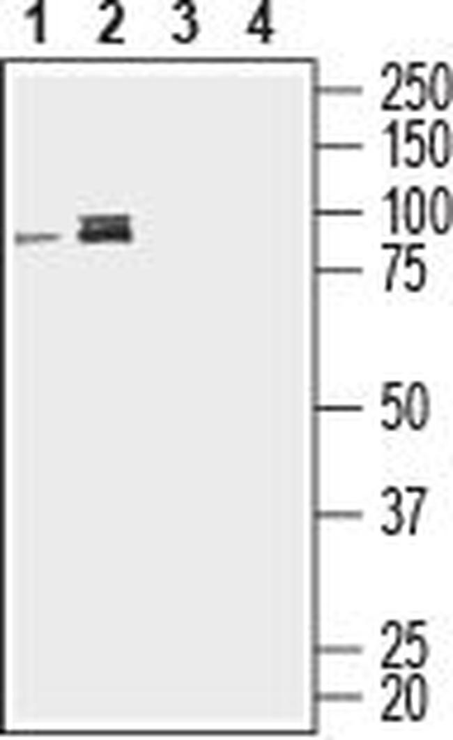 CD39 (extracellular) Antibody in Western Blot (WB)
