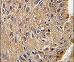 TEM8 Antibody in Immunohistochemistry (IHC)
