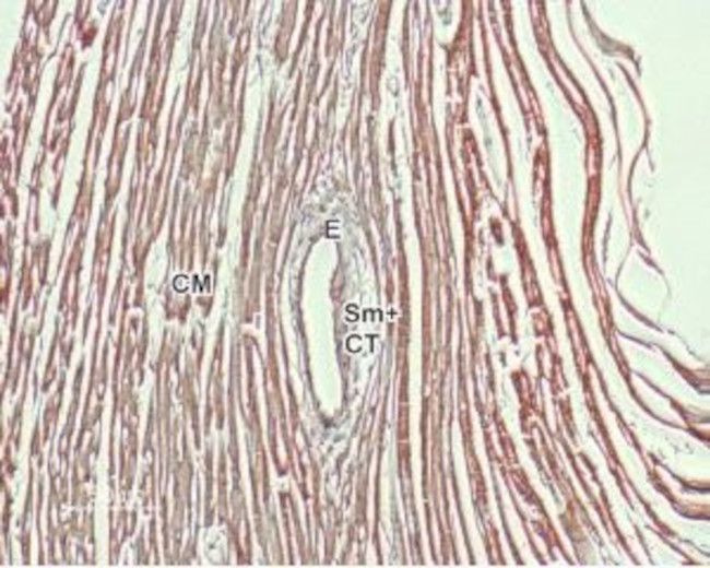 NCX1 (SLC8A1) Antibody in Immunohistochemistry (Paraffin) (IHC (P))