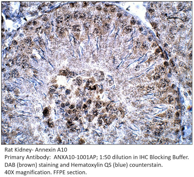 Annexin A10 Antibody in Immunohistochemistry (IHC)
