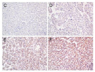 ANXA3 Antibody in Immunohistochemistry (Paraffin) (IHC (P))