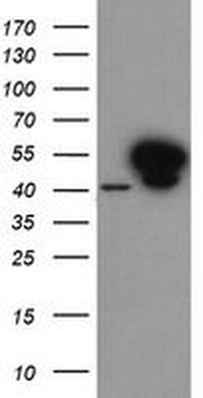 ANXA7 (Annexin VII) Antibody in Western Blot (WB)