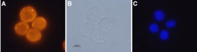 Orexin Receptor 1 Antibody in Immunocytochemistry (ICC/IF)