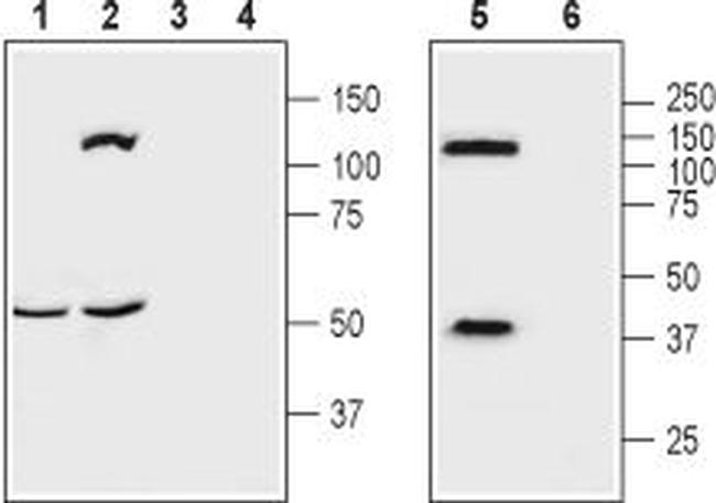 kappa-Opioid Receptor (OPRK1) (extracellular) Antibody in Western Blot (WB)