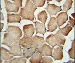 AP1S1 Antibody in Immunohistochemistry (IHC)