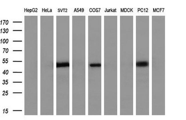 AP2M1 Antibody in Western Blot (WB)