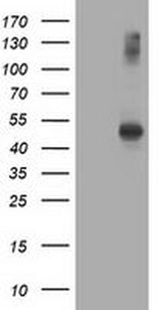 AP2M1 Antibody in Western Blot (WB)