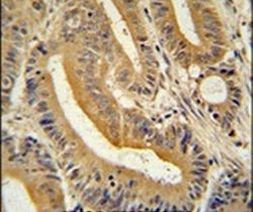 AP3S1 Antibody in Immunohistochemistry (IHC)