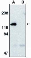 APAF1 Antibody in Western Blot (WB)