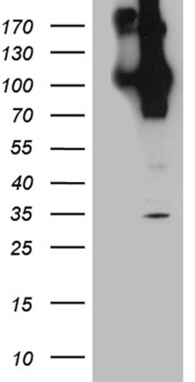 APBB1 Antibody in Western Blot (WB)