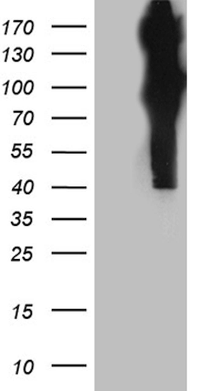 APBB1 Antibody in Western Blot (WB)