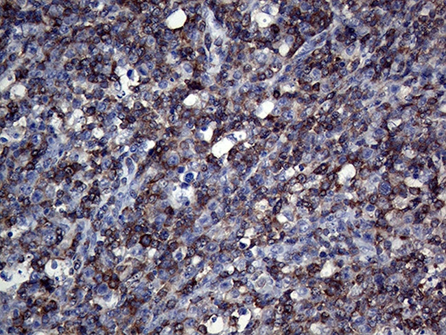 APBB1IP Antibody in Immunohistochemistry (Paraffin) (IHC (P))