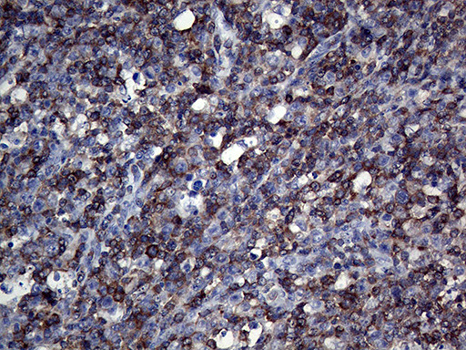 APBB1IP Antibody in Immunohistochemistry (Paraffin) (IHC (P))