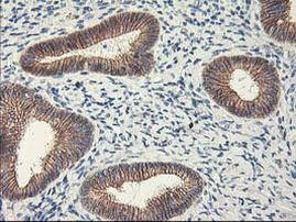 APBB3 Antibody in Immunohistochemistry (Paraffin) (IHC (P))
