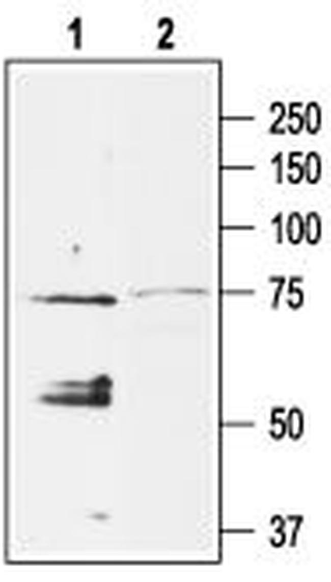 KCNJ5 (Kir3.4) Antibody in Western Blot (WB)