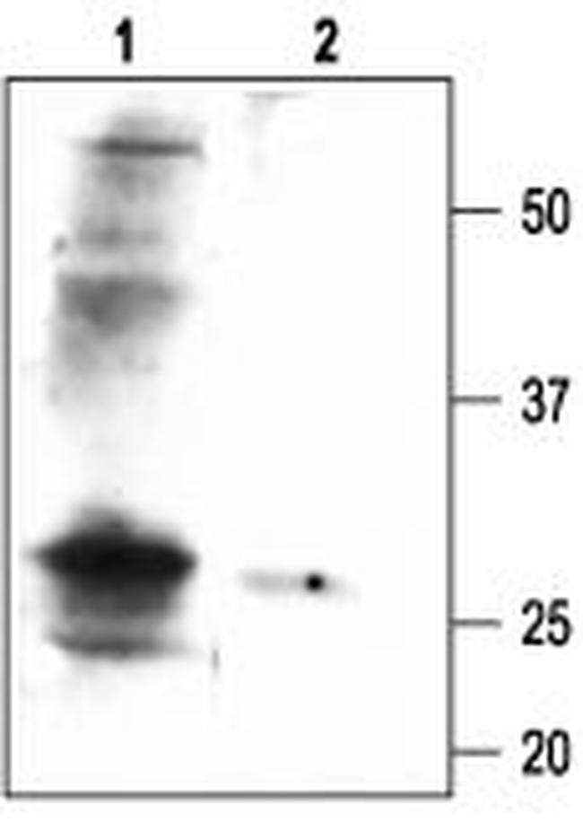 slo beta 1 (KCNMB1) Antibody in Western Blot (WB)