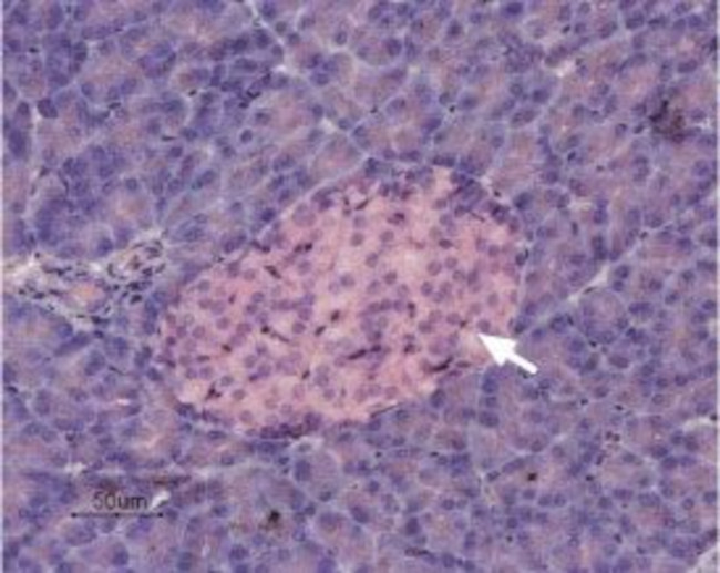 KCNK5 (TASK-2) Antibody in Immunohistochemistry (Paraffin) (IHC (P))