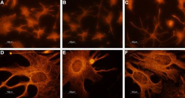 CNGA2 Antibody in Immunocytochemistry (ICC/IF)