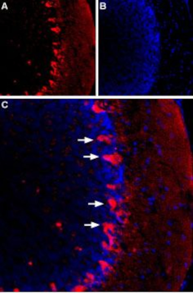 HCN1 Antibody in Immunohistochemistry (IHC)