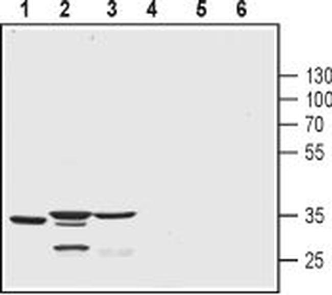 KChIP3 (CSEN, DREAM) Antibody in Western Blot (WB)