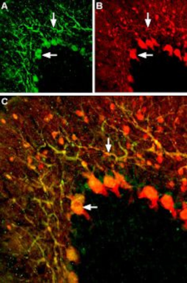 KV1.5 (KCNA5) (extracellular) Antibody in Immunohistochemistry (IHC)