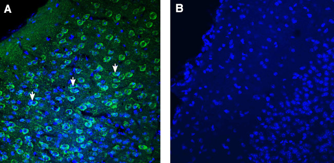 TMEM175 Antibody in Immunohistochemistry (Frozen) (IHC (F))
