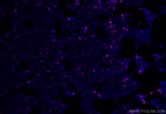 6x His, His-Tag Antibody in Immunocytochemistry (ICC/IF)