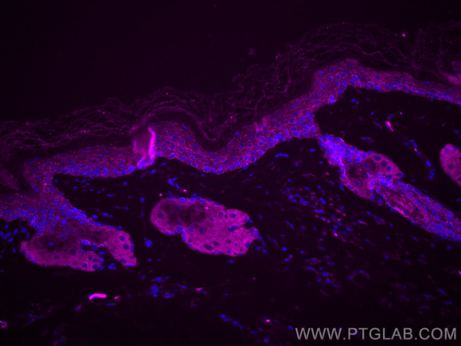 TACSTD2/TROP2 Antibody in Immunohistochemistry (Paraffin) (IHC (P))