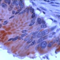 Protein APC Antibody in Immunohistochemistry (IHC)