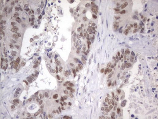 APC Antibody in Immunohistochemistry (Paraffin) (IHC (P))
