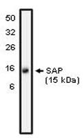 SH2D1A Antibody in Western Blot (WB)