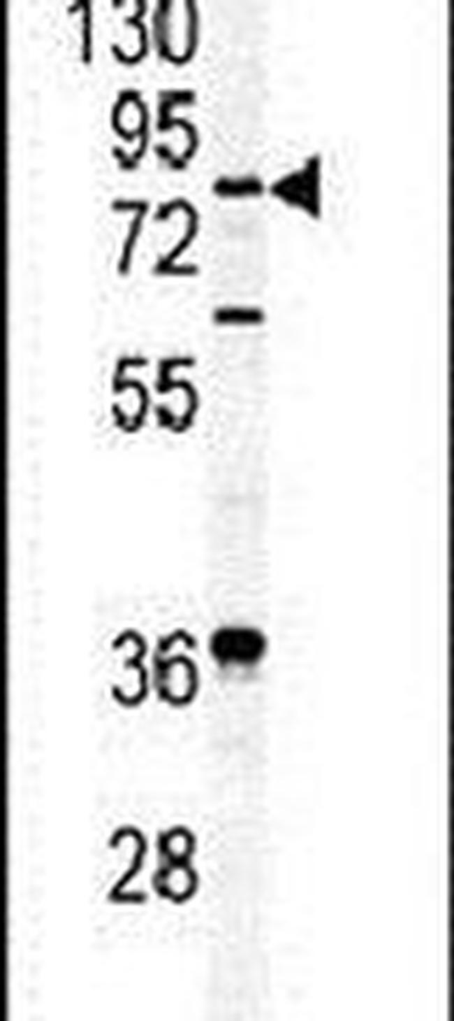 APEH Antibody in Western Blot (WB)
