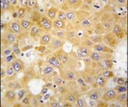 APH1 Antibody in Immunohistochemistry (IHC)