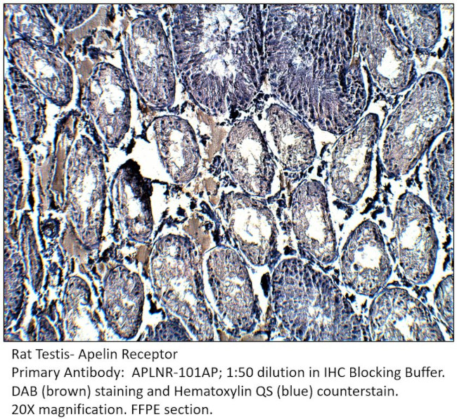 Apelin Receptor Antibody in Immunohistochemistry (IHC)