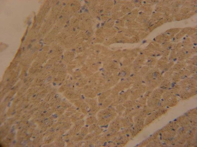 APOBEC2 Antibody in Immunohistochemistry (IHC)