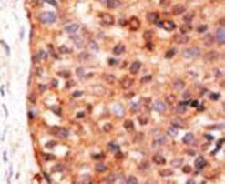 APOBEC3G Antibody in Immunohistochemistry (IHC)