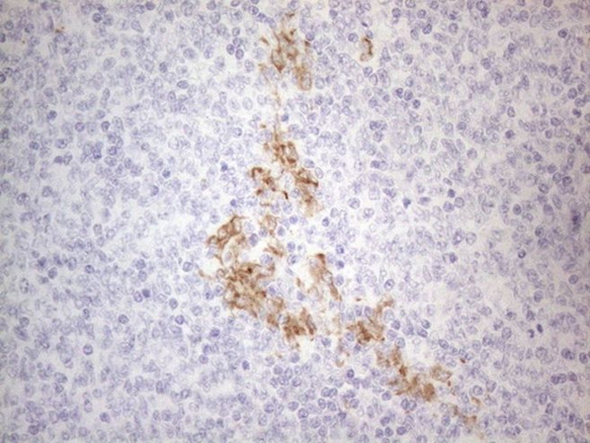 APOBR Antibody in Immunohistochemistry (Paraffin) (IHC (P))